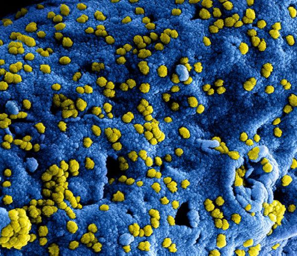 Digitally colorized scanning electron microscopic image of a coronavirus (MERS-CoV) by NIAID