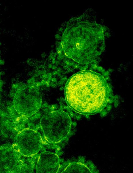 Digitally colorized transmission electron microscopic image of a coronavirus (MERS-CoV) by NIAID